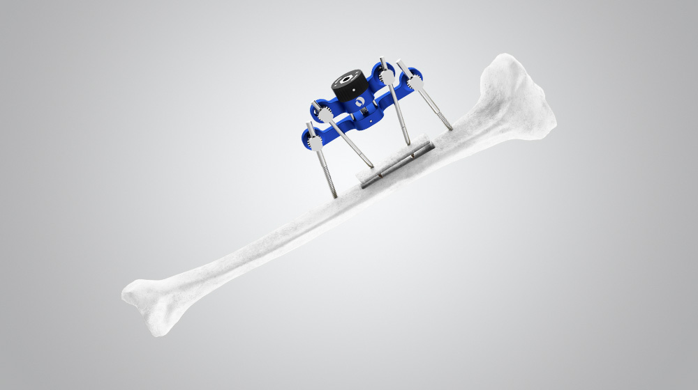 TrueLok Elevate System